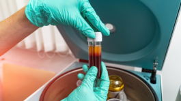 Plasma rico en plaquetas